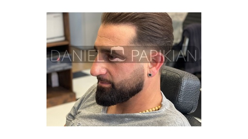 Taille de Barbe + Rasage des Contours 20€